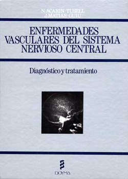Enfermedades vasculares del sistema nervioso central